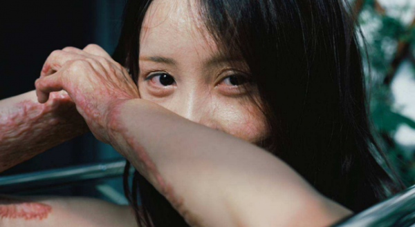 十年前，因拒絕官二代追求，被潑汽油燒至毀容的女孩，你還好嗎？