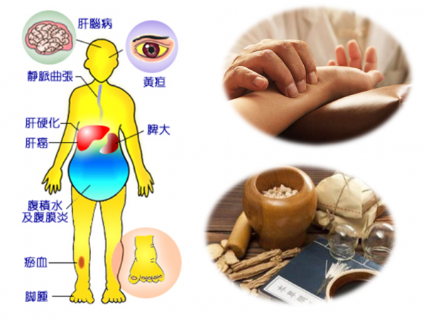 978萬人研究表明:每天喝點“小酒”,比偶爾喝“大酒”更傷身 978萬人研究表明:每天喝點“小酒”,比偶爾喝“大酒”更傷身