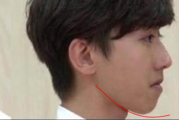 “假臉”大比拼?薛之謙變化大、羅志祥五官前後對比驚人 “假臉”大比拼?薛之謙變化大、羅志祥五官前後對比驚人