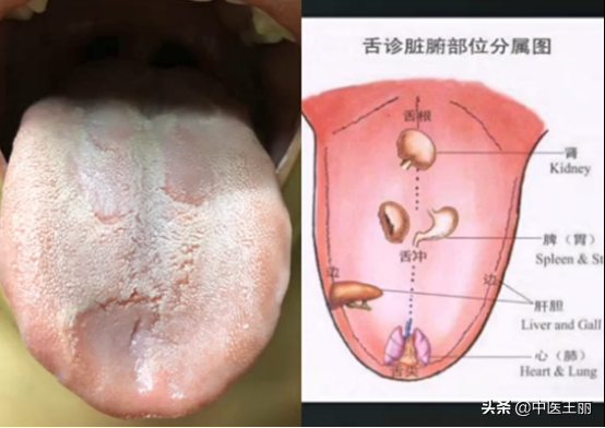 從舌頭看健康：今天和大家分析四個典型的舌診型別，每日舌診分析