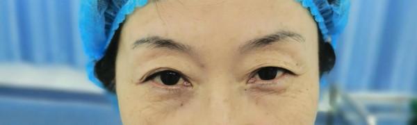 作為整形醫生，該不該整形，我給你怎麼的建議？