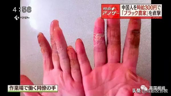 別人的命不值錢？日本公司竟騙外國勞工清理核汙染垃圾