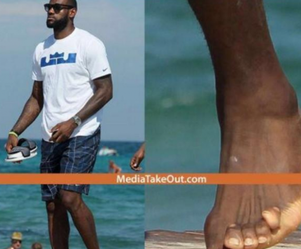 詹皇的腳 科比的手 姚明的膝蓋，看完你還羨慕他們拿高薪嗎？