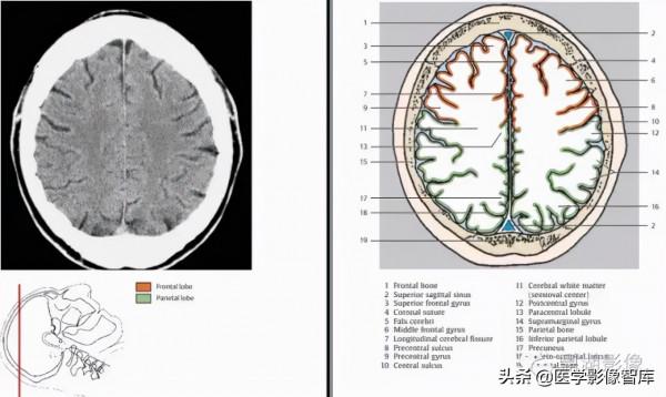 CT斷層解剖圖譜最全總結「推薦收藏」 CT斷層解剖圖譜最全總結「推薦收藏」