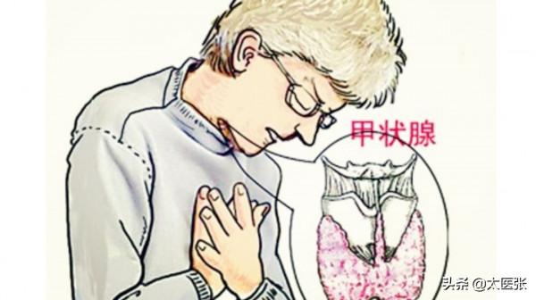 甲狀腺出了問題，我還能吃啥？