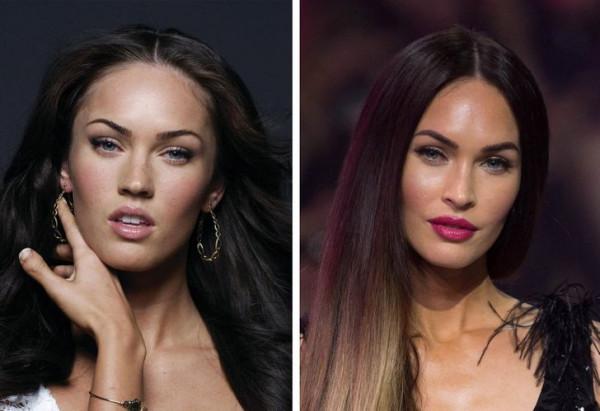 在轉向整形外科手術之前，10位明星真實的樣子，簡直面目全非