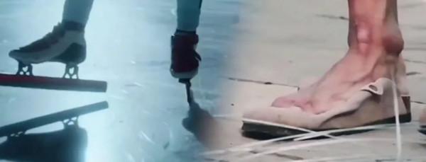 這張X光片刷屏！網友：破大防了......