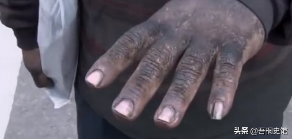 韓國大叔每天用鞋油抹臉，陪伴妹妹街頭流浪10年，只因親情的力量