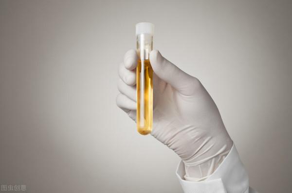 出現血尿沒有太在意,熬了兩個月被查出早期膀胱癌 出現血尿沒有太在意,熬了兩個月被查出早期膀胱癌