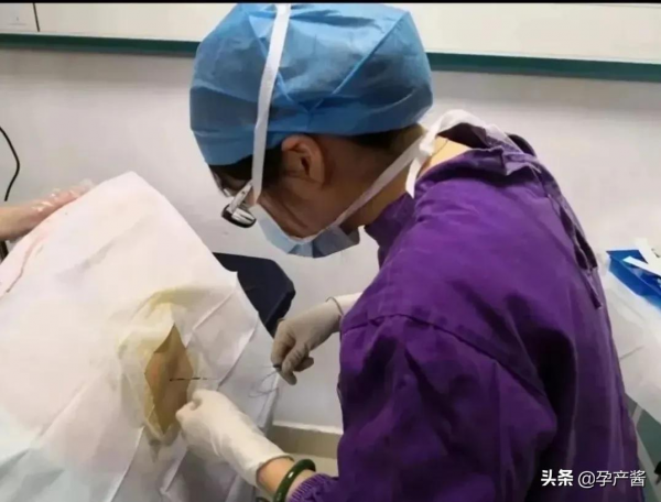 我在韓國醫院超快順產記：從進手術室到生完處理完一共用時30分鐘