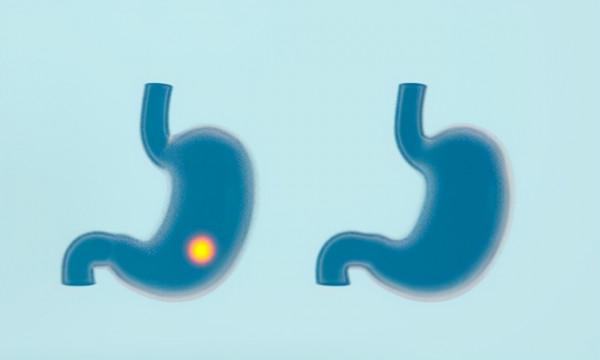 胃不好的人，5種“蔬菜”，建議儘量少擺上餐桌