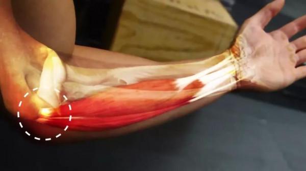 健身「肘關節」疼痛的3大常見原因、及解決方式 健身「肘關節」疼痛的3大常見原因、及解決方式