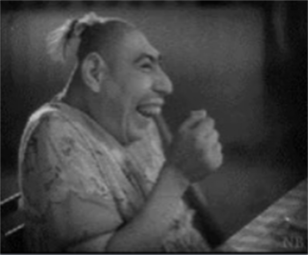 1997年，中科院對“猴娃”進行屍檢，研究者：它是小腦症患者