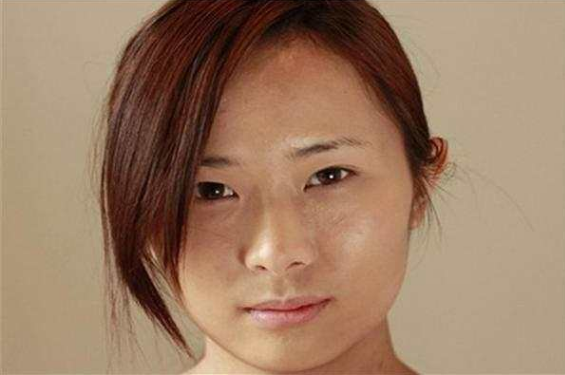 45歲家庭主婦祛斑半年,面板白皙,逆齡經驗分享,她是如何做的? 45歲家庭主婦祛斑半年,面板白皙,逆齡經驗分享,她是如何做的?