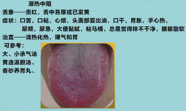 9種“熱”藏於體內，不同舌象，不同症狀，看看你是屬於哪一種