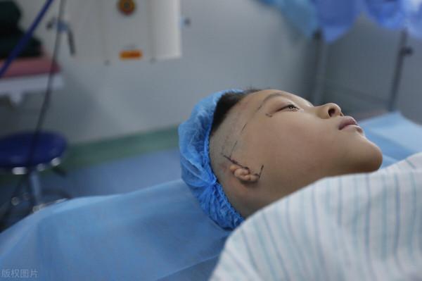 孩子沒有耳朵怎麼辦?外耳再造術可以幫助你! 孩子沒有耳朵怎麼辦?外耳再造術可以幫助你!