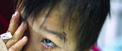 7歲被父親用菸頭燙、用針扎而離家，如今事業有成父親才來求原諒