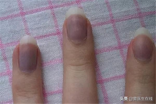 為什麼有的人指甲上有月牙，有的人卻沒有？