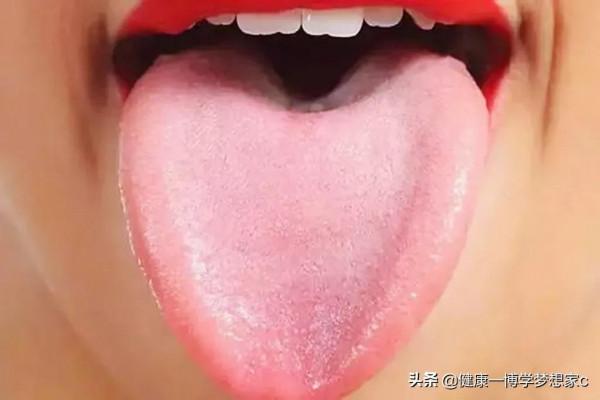早起照鏡子,你的舌頭邊上有沒有齒痕,齒痕舌代表什麼意思 早起照鏡子,你的舌頭邊上有沒有齒痕,齒痕舌代表什麼意思
