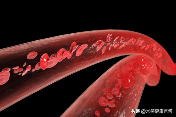 荷蘭最新研究:每天吃40g的魚,冠心病死亡風險降低27% 荷蘭最新研究:每天吃40g的魚,冠心病死亡風險降低27%