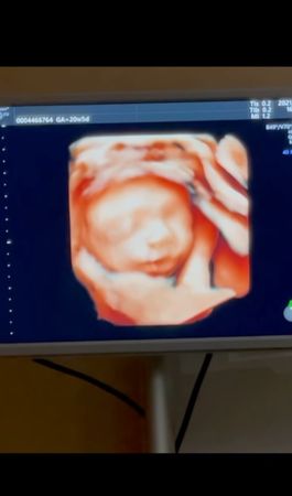 《雙層公寓》第1個寶寶！島袋聖南懷孕了 小10歲航空富二代樂當爸