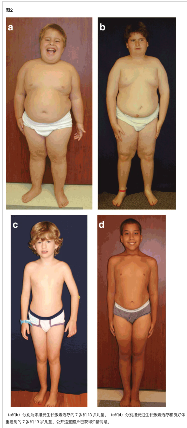 兒子餓到吃狗糧,我卻不能讓他吃飯 兒子餓到吃狗糧,我卻不能讓他吃飯