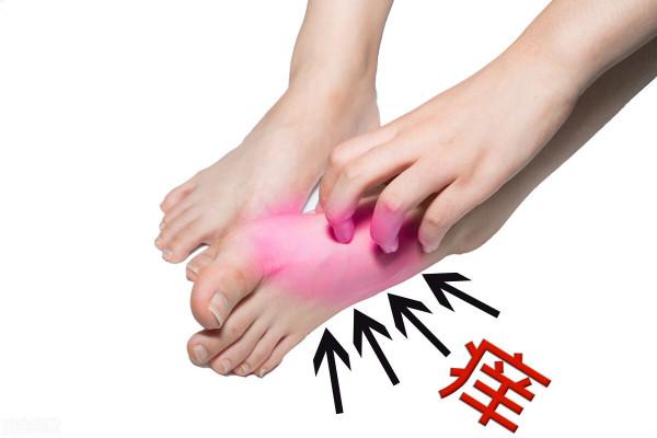 足癬？兩味中藥泡腳，除溼，殺菌，止癢