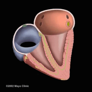 揭秘手術檯丨房顫導管消融術到底什麼樣兒? 揭秘手術檯丨房顫導管消融術到底什麼樣兒?