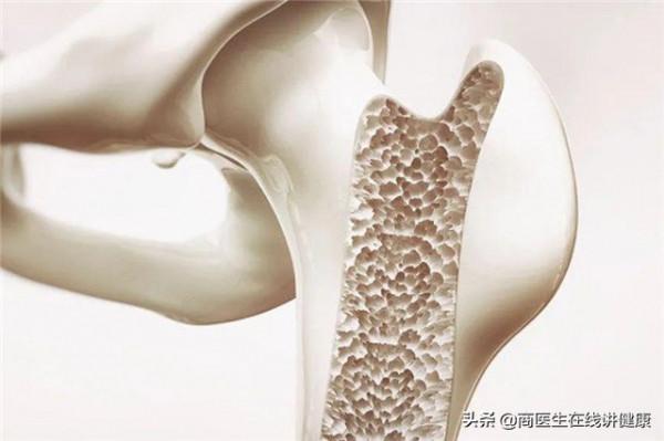 骨質疏鬆,鈣片啥時候吃最好?會不會致腎結石? 骨質疏鬆,鈣片啥時候吃最好?會不會致腎結石?