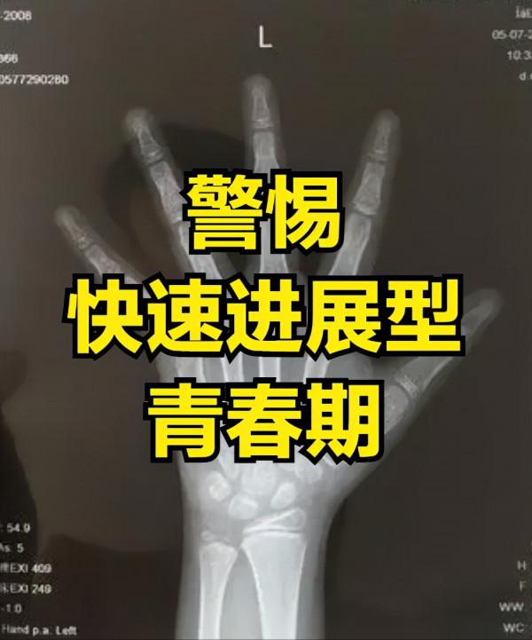 青春期男孩、女孩每年長多少為正常？做好4點，能長更多更高