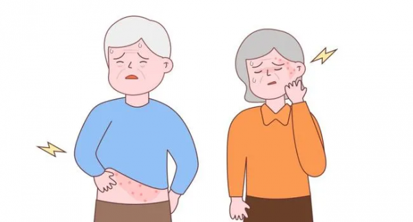 痛得要命！73歲阿姨臉上冒出連串的“北斗七星”，只因病毒深藏不露