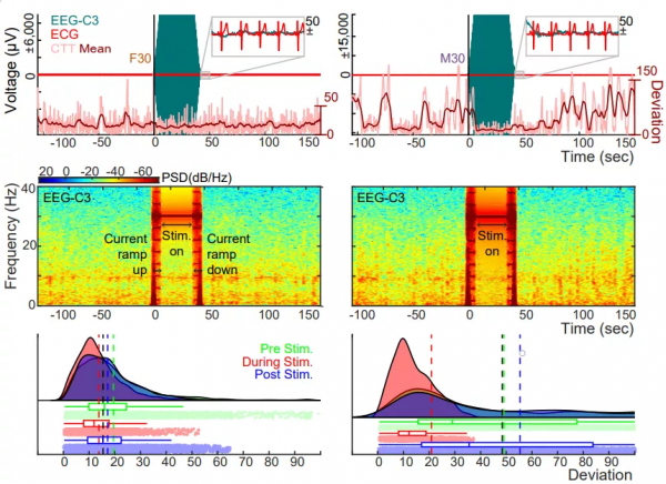 併發腦電圖、心電圖和多劑量經顱電刺激行為的資料集 併發腦電圖、心電圖和多劑量經顱電刺激行為的資料集