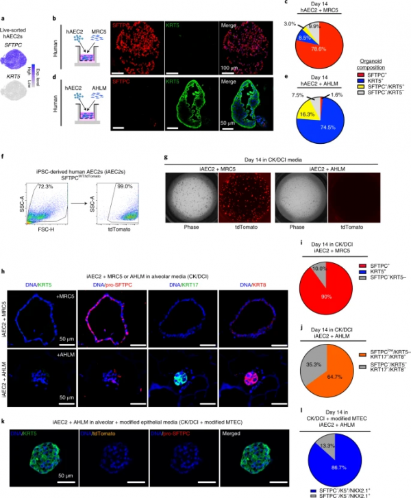 「Nature子刊」利用幹細胞類器官模型，揭示受COVID-19損傷的肺和肺纖維化中獨特的幹細胞軌跡