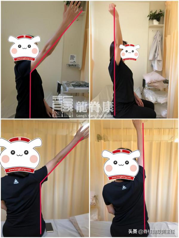 肩膀疼痛、麻木竟與頸椎有關係?該怎麼處理? 肩膀疼痛、麻木竟與頸椎有關係?該怎麼處理?