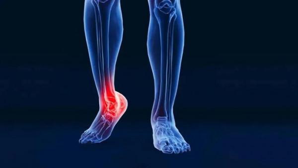 30歲女子每天跳繩1000個致骨折!你還在盲目跳繩減肥? 30歲女子每天跳繩1000個致骨折!你還在盲目跳繩減肥?