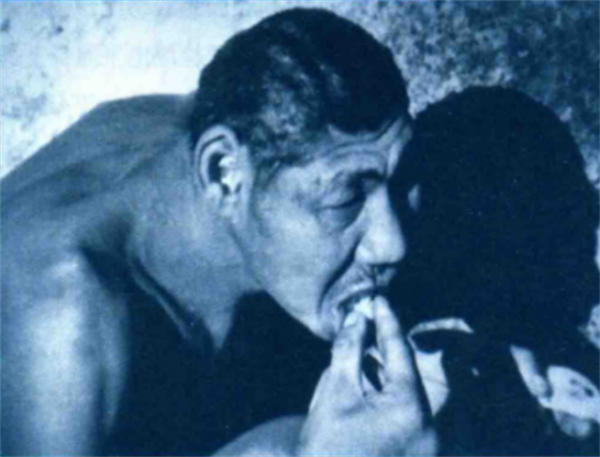 1997年，中科院對“猴娃”進行屍檢，研究者：它是小腦症患者