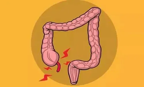 有些“肚子疼”延誤不得，你需要了解這些知識