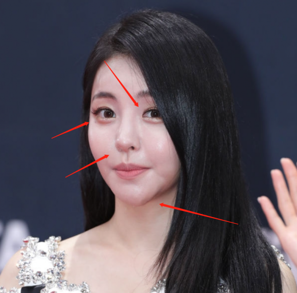 好多整容臉！外網曝韓國頒獎禮生圖，明星動鼻子後遺症太明顯