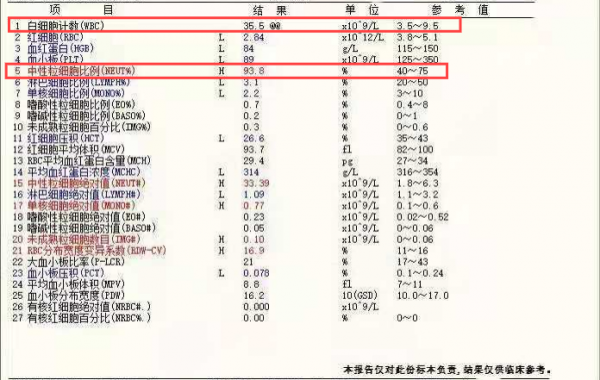 一例慢性中性粒細胞白血病病例分享