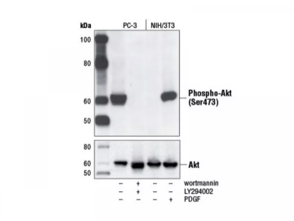 嗅嗅網丨Western blot：從實驗小白進階到高手的秘籍