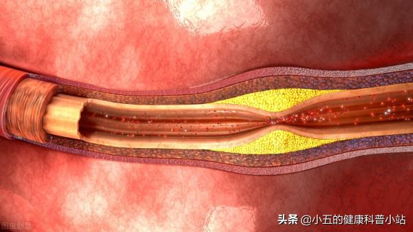 便宜的谷維素是治療失眠、高血脂的良藥,服用時注意4個問題 便宜的谷維素是治療失眠、高血脂的良藥,服用時注意4個問題
