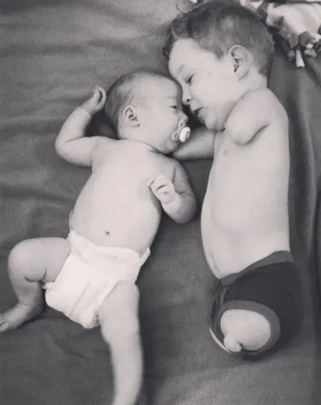 B超嬰兒無四肢,18歲媽媽拒絕墮胎,冒險生子,把孩子養成男子漢 B超嬰兒無四肢,18歲媽媽拒絕墮胎,冒險生子,把孩子養成男子漢