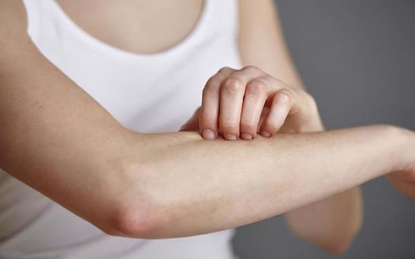 過敏性紫癜偶爾一兩個紅點，會影響到腎臟嗎？