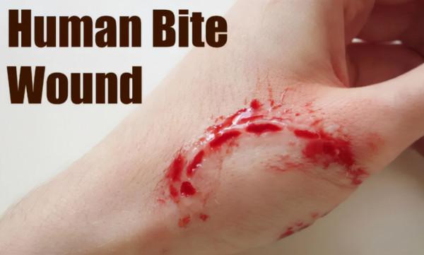 為啥狂犬病毒的致死率是99.99%,而不是100%,剩下的0.01%是誰? 為啥狂犬病毒的致死率是99.99%,而不是100%,剩下的0.01%是誰?