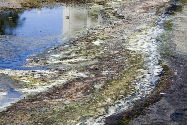 59歲的養生專家,因腸癌去世,為何生活健康的人也會患癌? 59歲的養生專家,因腸癌去世,為何生活健康的人也會患癌?