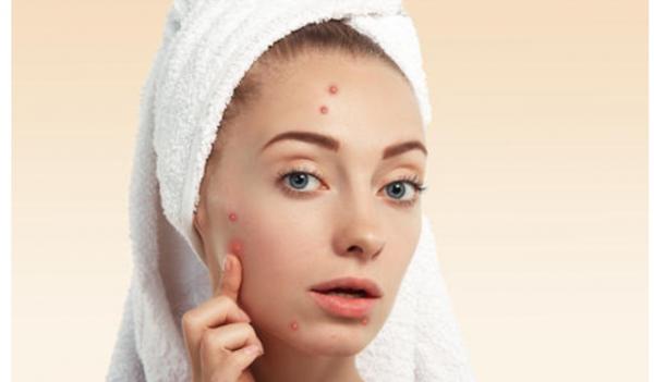 建議有“閉口”的女生，堅持做好這幾件事，高效解決不反覆