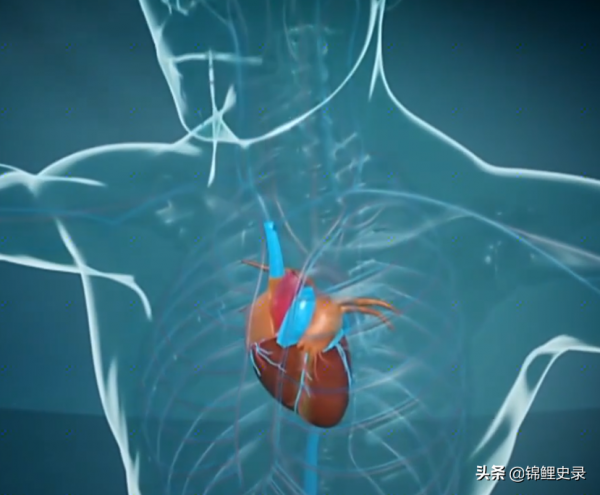 真實故事:浙江27歲小夥患癌症,為活命移植50歲心臟,最終結局如何