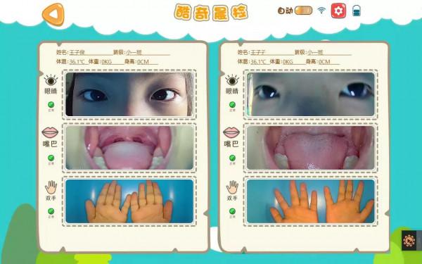 晨檢機器人,防疫最前哨,助力幼兒園 晨檢機器人,防疫最前哨,助力幼兒園