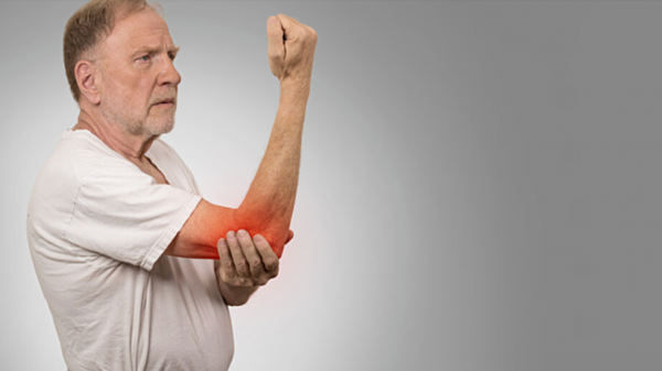 哪些人更容易患骨質疏鬆？&OpenCurlyDoubleQuote;1個公式&plus;1個測試&rdquo;教你自測骨質疏鬆