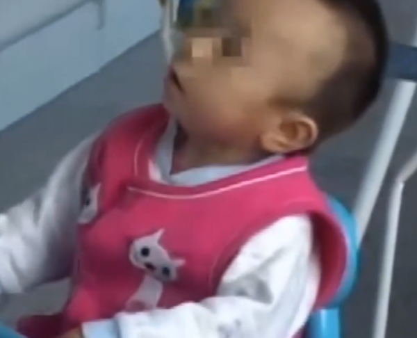 真實故事：陝西1歲幼童患怪病，身體長出鐵釘，醫生查明真相